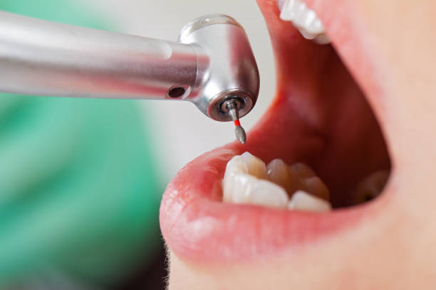 Best Emergency Dentist for Knocked-Out Tooth in Danbury, CT